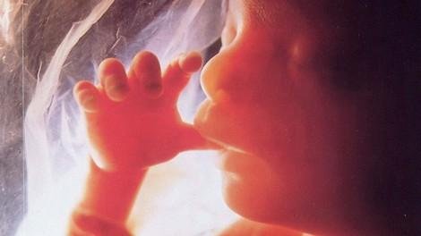808-Bebe-u-stomaku-placu-sanjaju-igraju-se.jpg, 12 KB